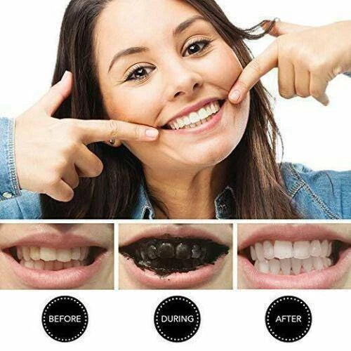 😁✨ Polvo Negro Blanqueador Dental – Sonríe con confianza